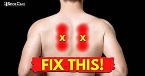 How to Fix SHARP Pain Between the Shoulder Blades