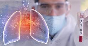新冠肺炎後遺症「肺纖維化」是什麼？有什麼症狀又該如何治療？｜天下雜誌
