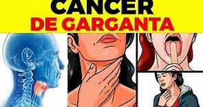 10 señales iniciales de cáncer de garganta