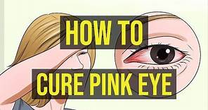 How To Cure Pink Eye Fast | 5 Quick Ways