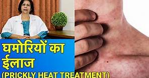 घमोरियों का ईलाज || Prickly Heat Treatment In HINDI