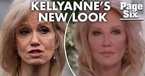 Plastic surgeon Stephen Greenberg explains Kellyanne Conway’s new look | Page Six Celebrity News