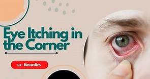 Eye Itching in the Corner | 14 Causes + 10 Eye Itching in the Corner Home Remedy
