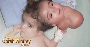 The 2-Headed Baby Miracle | The Oprah Winfrey Show | Oprah Winfrey Network