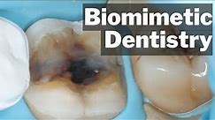 Biomimetic Dentistry - What Actually Is It? - PDP135
