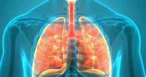 Bronconeumonía: síntomas, causas y tratamiento