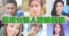 23位香港女星整容前后成功vs失败案例、怪不得整容事业那么好