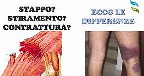 Contrattura, stiramento o strappo muscolare? Ecco come distinguere.