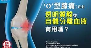 O型膝痛：注射透明質酸或自體分離血液，有用嗎？(K39d)(3D Animation)