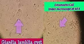 Difference between Giardia Lamblia & Entamoeba Coli cyst.Best view under microscope at 40 X.