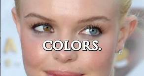 Kate Bosworth has two different-colored eyes