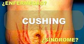 ¿Síndrome de Cushing o Enfermedad de Cushing? Diferencias