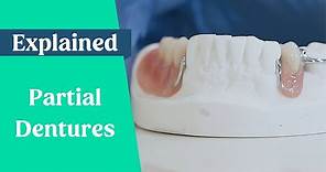 Partial dentures & false teeth explained