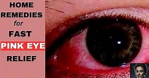 How To Get Rid Of Pink Eye Fast | Home Remedies & Natural Treatments
