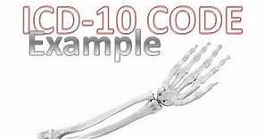 How to Code Correctly with ICD-10