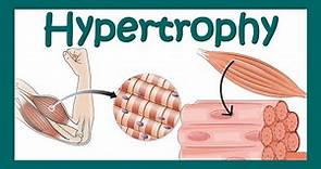 Hypertrophy | What is hypertrophy? | Mechanism of muscle hypertrophy | How does hypertrophy happen?
