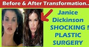 Janice Dickinson Plastic Surgery Before and After Full HD