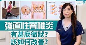 脊醫王鳳恩 - 強直性脊椎炎, 有什麼徴狀, 該如何改善, 拉筋舒緩晨僵 !!