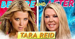 Tara Reid | Before & After | Transformation After Multiple Surgeries?