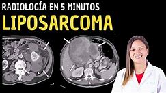 Radiología en 5 minutos: Liposarcoma.