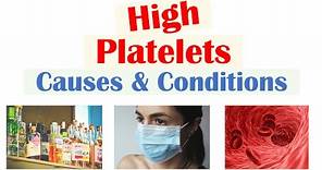 Causes of High Platelets (Thrombocytosis) | Rapid Review