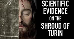 Scientific Evidence on the Shroud of Turin