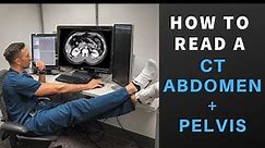 How to Read a CT Scan