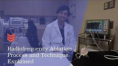 Radiofrequency Ablation Technique and Process Explained
