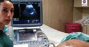 PRÁCTICA No. 8 La Antropometría Fetal y el Ultrasonido