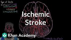 Ischemic stroke | Circulatory System and Disease | NCLEX-RN | Khan Academy