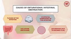 What is acute intestinal obstruction? Types, symptoms and treatment