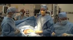 Laparoscopic Sleeve Gastrectomy Video - Brigham and Women's Hospital