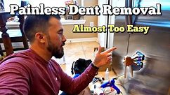 Removing Dent from A Refrigerator Door Using Amazon's Best Selling Kit Its a How To and Review