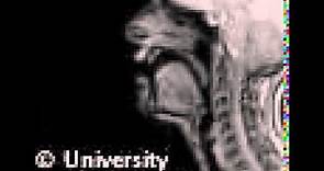 MRI voiceless postalveolar fricative