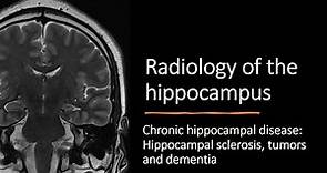 Radiology of the hippocampus - chronic hippocampal disease