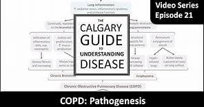 COPD Pathogenesis