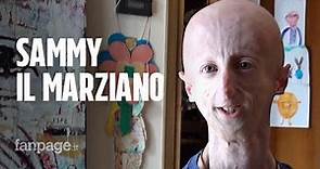 Sammy Basso, una vita con la progeria: "Studio una ricerca per fare del bene agli altri"
