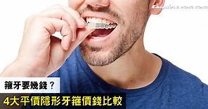 箍牙要幾錢？2022年香港4大平價隱形牙箍價錢比較：SmileDirectClub/Zenyum/SmileLove/Invisalign Go