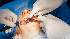 Plastic surgery booming as pandemic eases