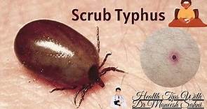 Scrub Typhus /Early diagnosis and treatment