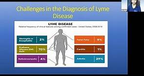Early Signs and Symptoms of Lyme Disease