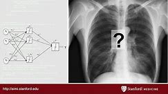 AI in Radiology at Stanford: Rise of the Machines