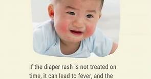 How to Spot and Treat Diaper Rash?