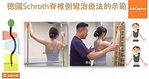 物理治療師 - 鄭進成 (Aldous) 示範德國Schroth脊椎側彎治療法-單胸彎