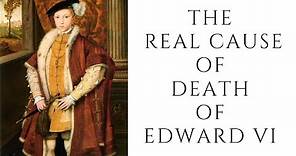 The REAL Cause Of Death Of Edward VI