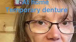 At home Temp dentures. Do they work? Easy Dentures #denturegang #dentures #toothless #easydentures