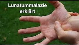 Lunatummalazie - Handschmerzen im Mondbein
