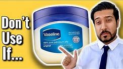 Vaseline on Face | Watch FIRST Before Using! 🚨