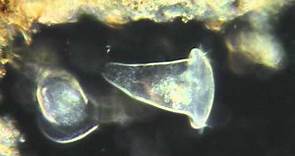 Vorticelles (Vorticella sp.)