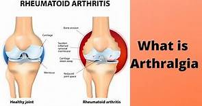 What is Arthralgia